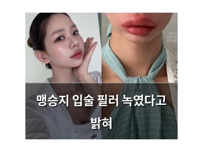 맹승지 입술 필러 녹였다고 밝혀